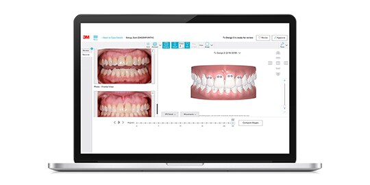 Laptop with oral care case on screen
