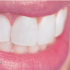Clinpro™ 5000 Toothpaste Patient Education Video